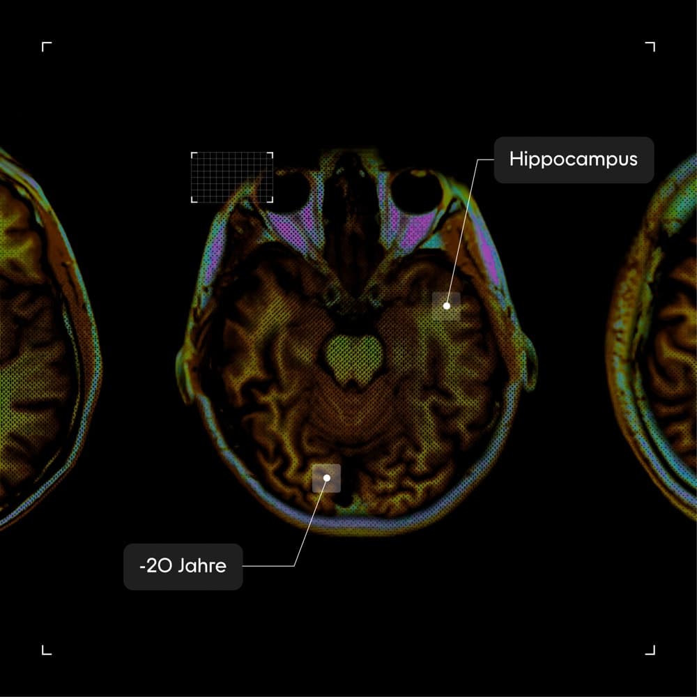 Neurodegenerative