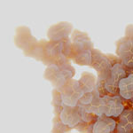 YEARS-Oraler-Glukosetoleranztest